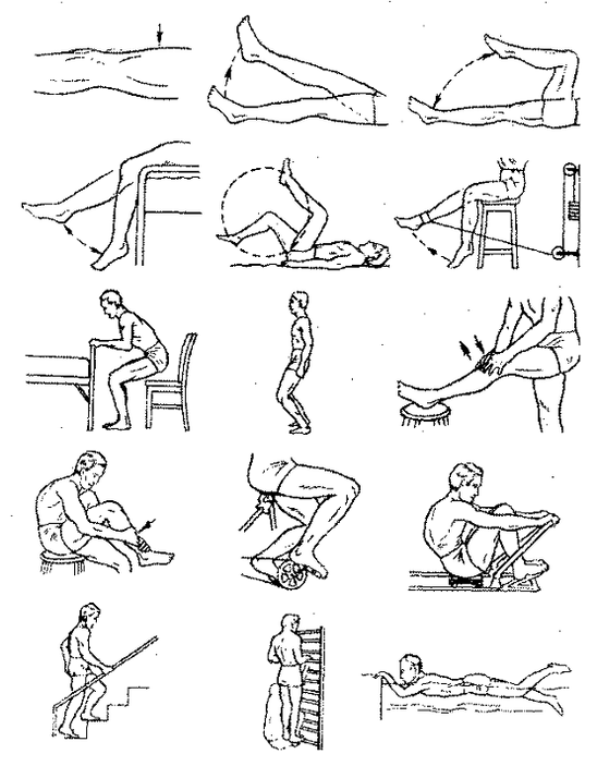 Ejercicios terapéuticos para la artrosis de la articulación de la rodilla